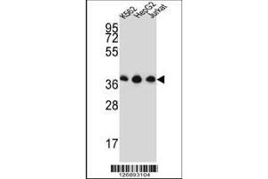 Image no. 1 for anti-Heterogeneous Nuclear Ribonucleoprotein D-Like (HNRPDL) (AA 206-234) antibody (ABIN651545)