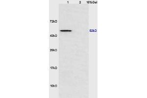 Lane 1: mouse heart lysates Lane 2: mouse brain lysates probed with Anti Scavenger Receptor BII Polyclonal Antibody, Unconjugated (ABIN873185) at 1:200 in 4 °C.