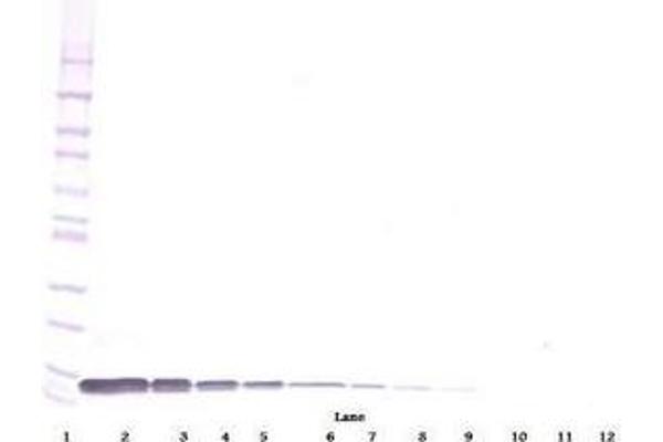 anti-Chemokine (C-X-C Motif) Ligand 12 (CXCL12) antibody