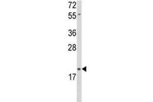 Image no. 4 for anti-delta-Like 2 Homolog (DLK2) (AA 353-380) antibody (ABIN3028612)