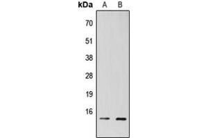 Image no. 2 for anti-TAF13 RNA Polymerase II, TATA Box Binding Protein (TBP)-Associated Factor, 18kDa (TAF13) (Center) antibody (ABIN2707135)