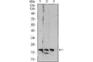 Image no. 9 for anti-RAB6B, Member RAS Oncogene Family (RAB6B) (AA 95-208) antibody (ABIN5542692)