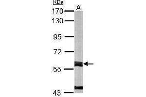 Image no. 3 for anti-Flavin Containing Monooxygenase 3 (FMO3) (Internal Region) antibody (ABIN2855649)