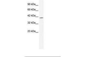 Image no. 1 for anti-ELK4, ETS-Domain Protein (SRF Accessory Protein 1) (ELK4) (C-Term) antibody (ABIN202507)