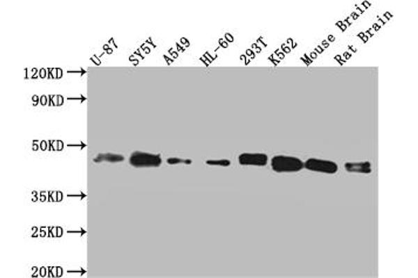 SPPL3 抗体  (AA 213-263)