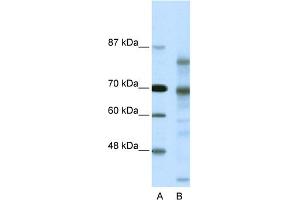 Image no. 1 for anti-Nuclear Receptor Co-Repressor 2 (NCOR2) (N-Term) antibody (ABIN2779658)