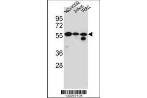 Image no. 1 for anti-Forkhead Box N2 (FOXN2) (AA 1-30), (N-Term) antibody (ABIN656184)