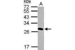 Image no. 3 for anti-14-3-3 theta (YWHAQ) (Center) antibody (ABIN2855319)
