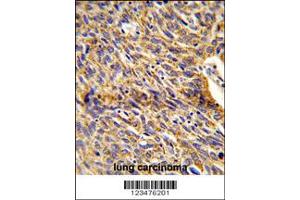 Immunohistochemistry (IHC) image for anti-Enoyl-CoA Delta Isomerase 1 (ECI1) antibody (ABIN2158492)