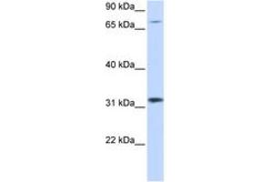 Image no. 1 for anti-Zinc Finger Protein 799 (ZNF799) (AA 261-310) antibody (ABIN6744479)