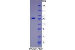 Image no. 3 for C-Reactive Protein (CRP) ELISA Kit (ABIN6574221)