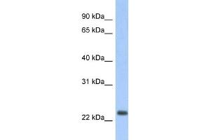 Image no. 1 for anti-Mitochondrially Encoded NADH Dehydrogenase 6 (MT-ND6) (Middle Region) antibody (ABIN2784118)