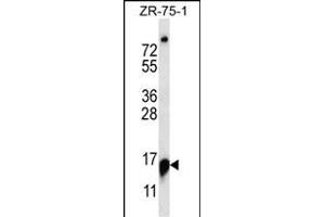 RPP25 抗体  (C-Term)