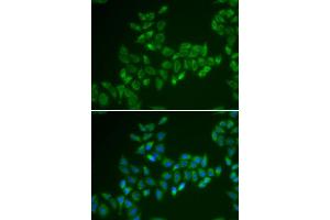 Image no. 2 for anti-Carnitine O-Acetyltransferase (CRAT) antibody (ABIN2561991)