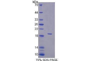 Image no. 1 for serpin Peptidase Inhibitor, Clade A (Alpha-1 Antiproteinase, Antitrypsin), Member 6 (SERPINA6) (AA 218-378) protein (His tag) (ABIN1170235)
