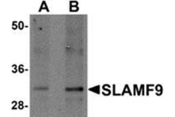 SLAMF9 antibody  (C-Term)