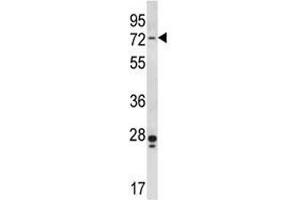 Image no. 2 for anti-P21-Activated Kinase 4 (PAK4) (AA 187-216) antibody (ABIN3032118)
