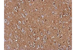 IHC-P Image Immunohistochemical analysis of paraffin-embedded CL1-5 xenograft, using AXL, antibody at 1:200 dilution.