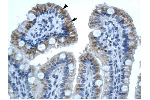 Image no. 1 for anti-Gap Junction Protein, beta 1, 32kDa (GJB1) (C-Term) antibody (ABIN630257)