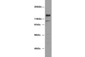 Image no. 1 for anti-Desmoglein 2 (DSG2) (AA 37-164) antibody (ABIN1742581)