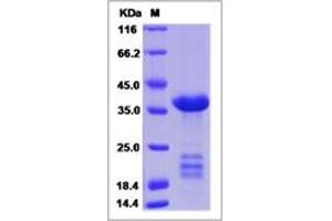 Image no. 1 for Insulin-Like Growth Factor Binding Protein 2, 36kDa (IGFBP2) (AA 1-305) protein (His tag) (ABIN2693487)