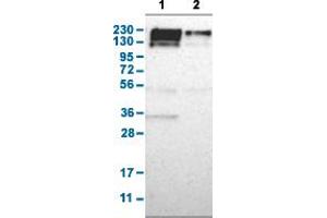 Image no. 2 for anti-Poly (ADP-Ribose) Polymerase Family, Member 4 (PARP4) antibody (ABIN5585258)