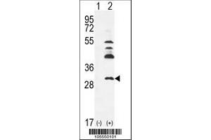 Image no. 1 for anti-Uridine-Cytidine Kinase 2 (UCK2) (AA 227-255), (C-Term) antibody (ABIN391287)