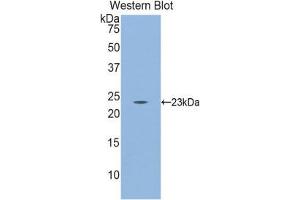 CD8B antibody  (AA 21-208)