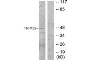 Image no. 1 for anti-Tripartite Motif Containing 59 (TRIM59) (AA 191-240) antibody (ABIN1533991)