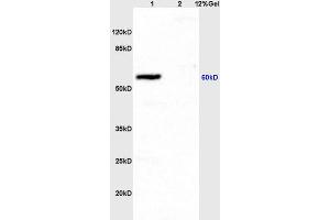 Image no. 4 for anti-Intercellular Adhesion Molecule 1 (ICAM1) (AA 201-300) antibody (ABIN670806)