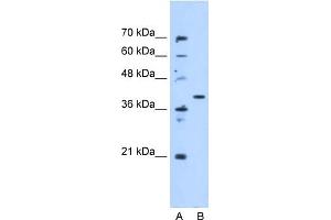 Image no. 1 for anti-Enoyl CoA Hydratase Domain Containing 3 (ECHDC3) (N-Term) antibody (ABIN629586)