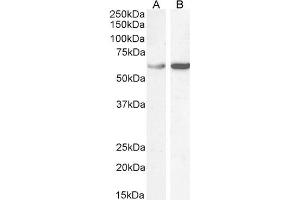 Image no. 4 for anti-T-Complex 1 (TCP1) (C-Term) antibody (ABIN185185)