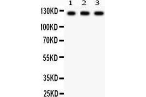 Image no. 1 for anti-Phospholipase D1 (PLD1) (AA 1-330) antibody (ABIN3043383)