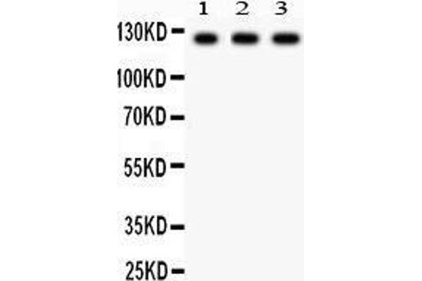 anti-Phospholipase D1 (PLD1) (AA 1-330) antibody