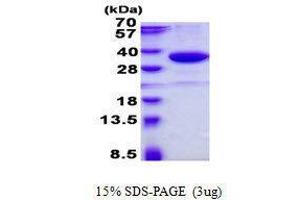 Image no. 1 for Single-Strand-Selective Monofunctional Uracil-DNA Glycosylase 1 (SMUG1) protein (ABIN2131874)