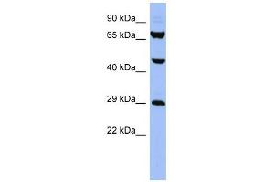 Image no. 1 for anti-Small Nuclear Ribonucleoprotein Polypeptides B and B1 (SNRPB) (N-Term) antibody (ABIN633272)