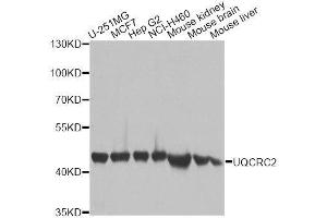 Image no. 2 for anti-Ubiquinol-Cytochrome C Reductase Core Protein II (UQCRC2) antibody (ABIN1683222)