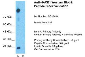 Image no. 1 for anti-HECT Domain and Ankyrin Repeat Containing, E3 Ubiquitin Protein Ligase 1 (HACE1) (Middle Region) antibody (ABIN2774769)