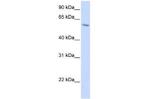 Image no. 1 for anti-Porcupine Homolog (PORCN) antibody (ABIN635157)