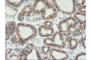 Image no. 5 for anti-Cadherin 2 (CDH2) antibody (ABIN1499626)