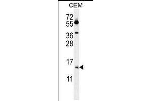 Image no. 1 for anti-Matrix Gla Protein (MGP) (AA 37-66) antibody (ABIN5531633)