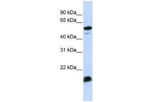 Image no. 1 for anti-Complement Component 4 Binding Protein, alpha (C4BPA) (Middle Region) antibody (ABIN634312)