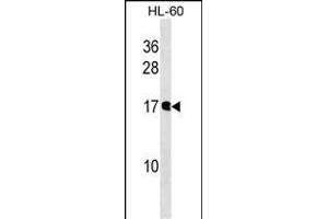 NUDT10 Antibody (N-term) (ABIN1538864 and ABIN2849903) western blot analysis in HL-60 cell line lysates (35 μg/lane).