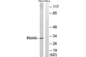 Image no. 2 for anti-Mitochondrial Ribosomal Protein L46 (MRPL46) (AA 111-160) antibody (ABIN1534532)