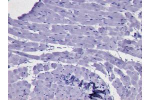 ABIN184728 Negative Control showing staining of paraffin embedded Human Bone Marrow, with no primary antibody.