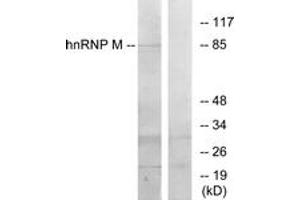 Image no. 1 for anti-Heterogeneous Nuclear Ribonucleoprotein M (HNRNPM) (AA 11-60) antibody (ABIN1533765)