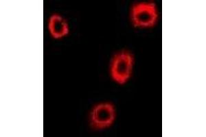 Image no. 1 for anti-Coatomer Protein Complex, Subunit beta 2 (COPB2) antibody (ABIN2966865)