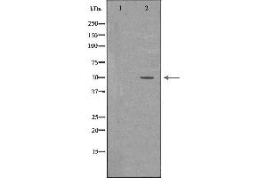 Image no. 2 for anti-Sarcoglycan, epsilon (SGCE) (Internal Region) antibody (ABIN6265039)