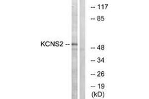 Image no. 1 for anti-Potassium Voltage-Gated Channel, Delayed-Rectifier, Subfamily S, Member 2 (KCNS2) (AA 197-246) antibody (ABIN1535193)