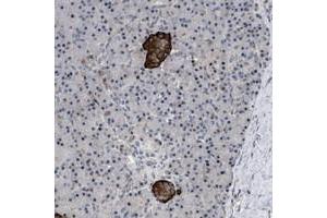 Image no. 1 for anti-Zinc Finger, DHHC-Type Containing 15 (ZDHHC15) antibody (ABIN5591192)